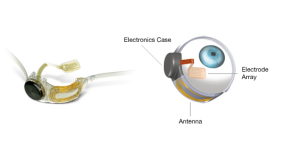 Eye