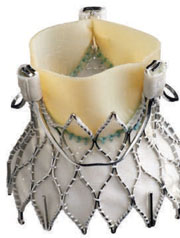 Medtronics Engager Transapical Valve