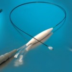Renal Denervation Back in Europe with ReCor Paradise™ Launch