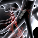 CardioMEMS™ HF Heart Monitoring Significantly Reduced 30-Day Hospital Readmission Rates