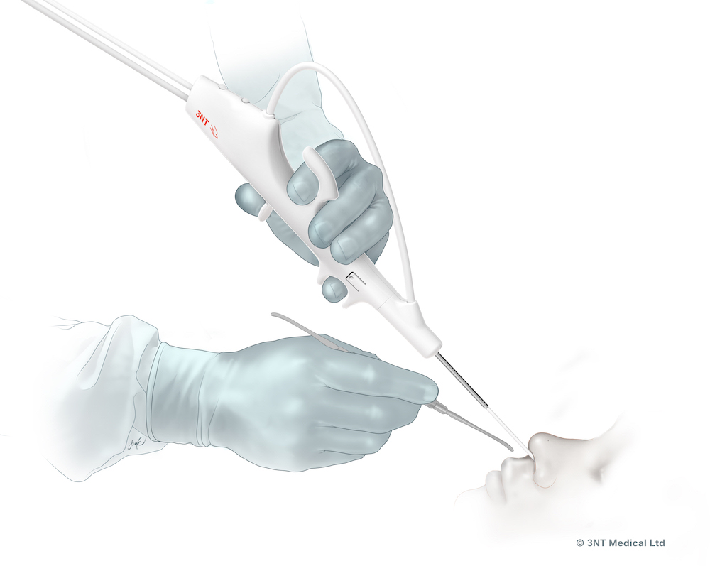 sinus surgery endoscope